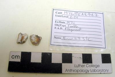 1976.001.00121; Faunal Bone- Tooth Fragment
